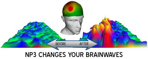 np3_changes_brainwaves